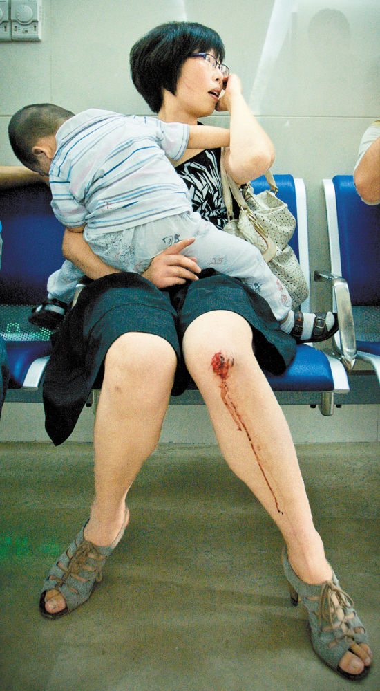 廣州崗頂?shù)罔F電梯發(fā)生意外 2人受傷